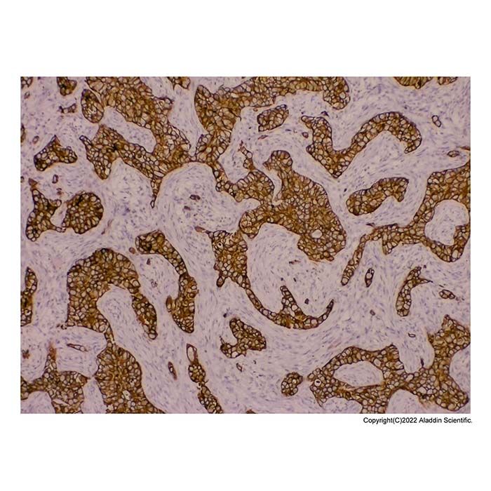 Recombinant pan Cytokeratin Antibody