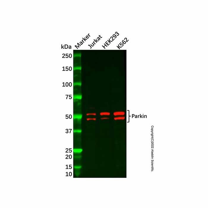 Recombinant Parkin Antibody