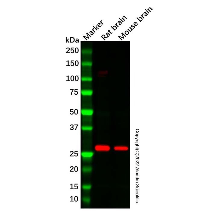 Recombinant PDGF B Antibody