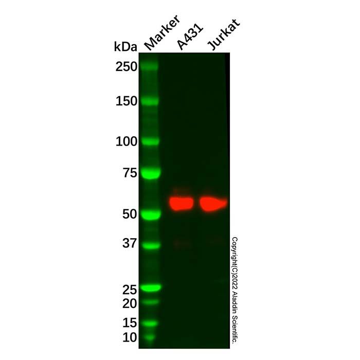 Recombinant PFKFB3 Antibody
