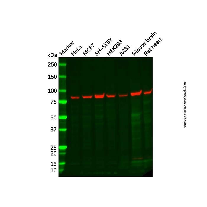 Recombinant PFKM Antibody