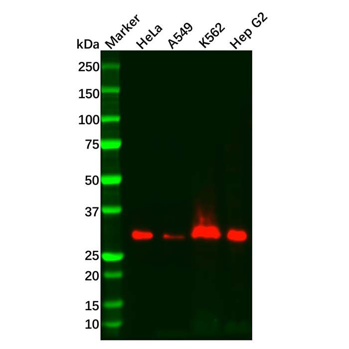 Recombinant PIM1 Antibody