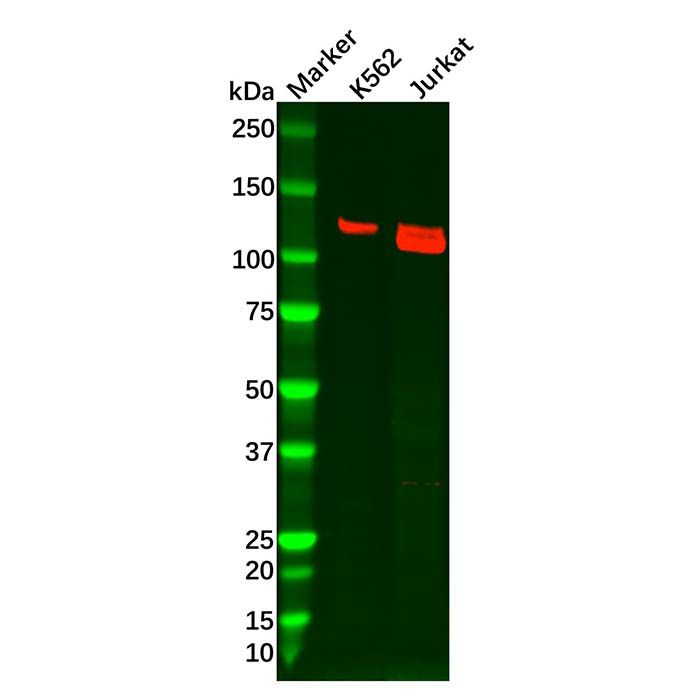 Recombinant PKN2 Antibody