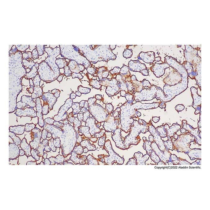 Recombinant Placental alkaline phosphatase (PLAP) Antibody