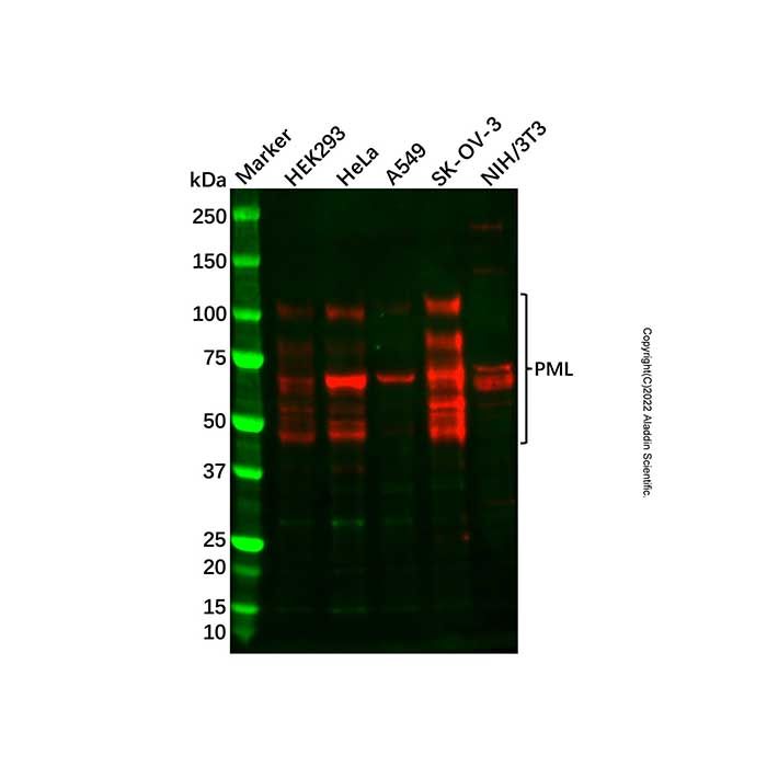 Recombinant PML Antibody