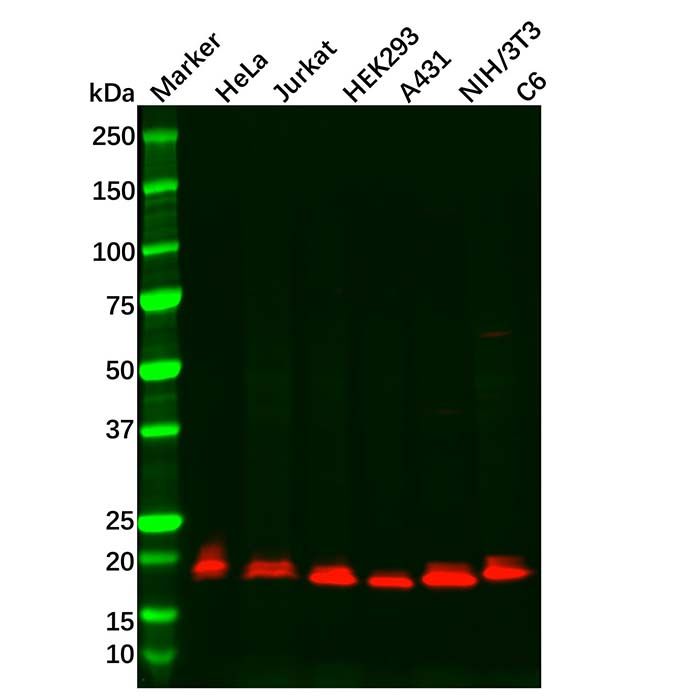 Recombinant Presenilin 1/PS-1 Antibody