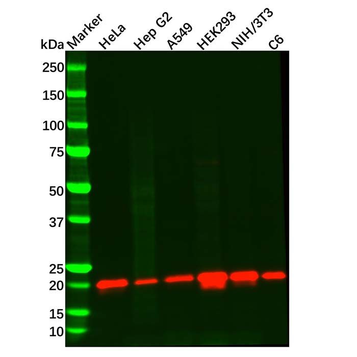 Recombinant Presenilin 2/AD5 Antibody