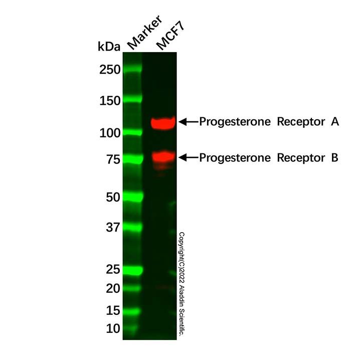 Recombinant Progesterone Receptor Antibody