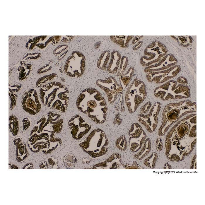 Recombinant Prostate Specific Antigen Antibody