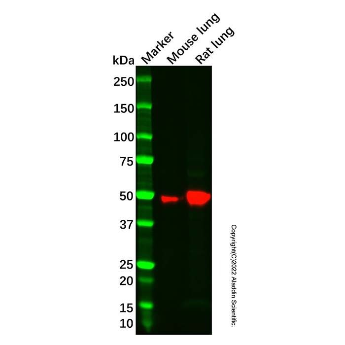Recombinant RAGE Antibody