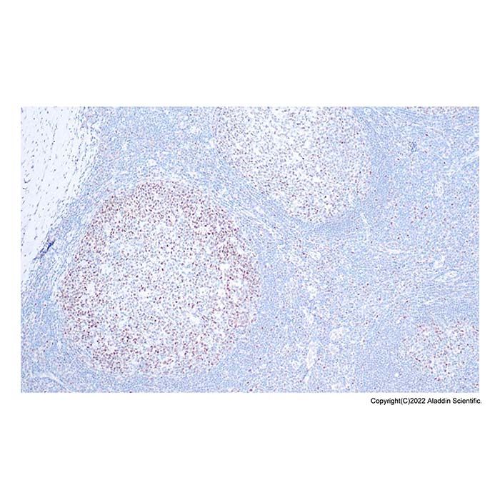 Recombinant Rb Antibody