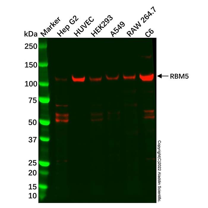 RBM5 Antibody