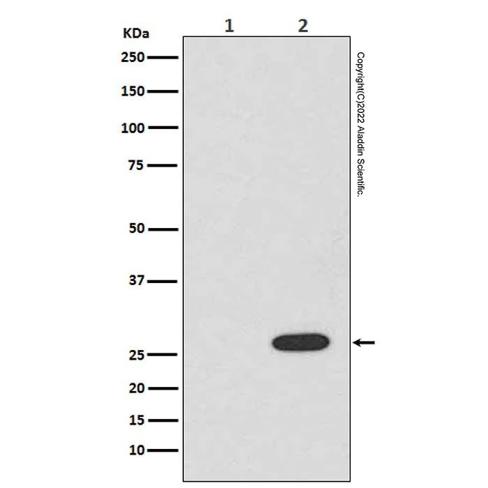 Recombinant RFP Antibody