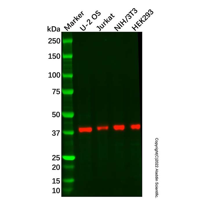 Recombinant RING2/RING1B/RNF2 Antibody
