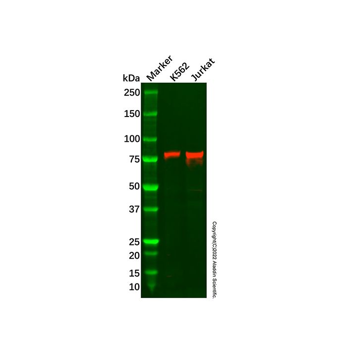 Recombinant RNase L Antibody