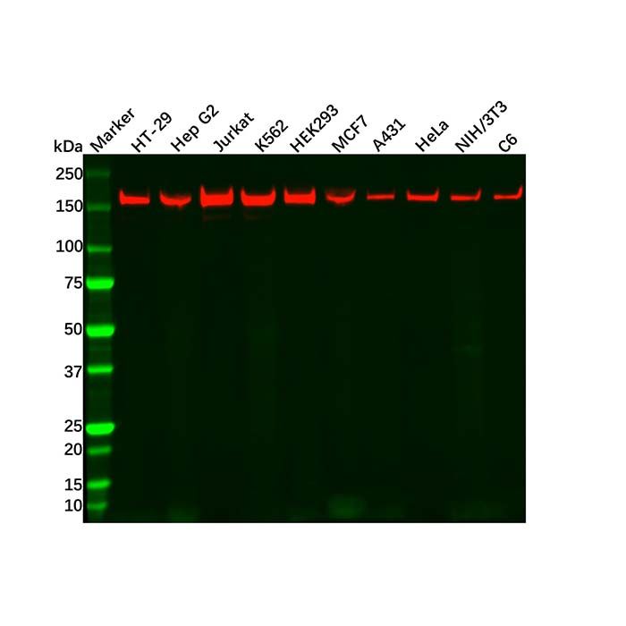 Recombinant ROCK1 Antibody