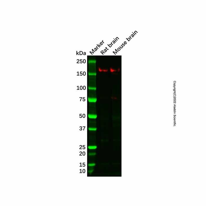 Recombinant ROCK2 Antibody