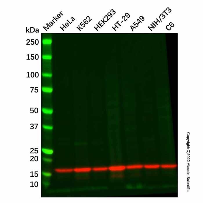 Recombinant RPS19 Antibody