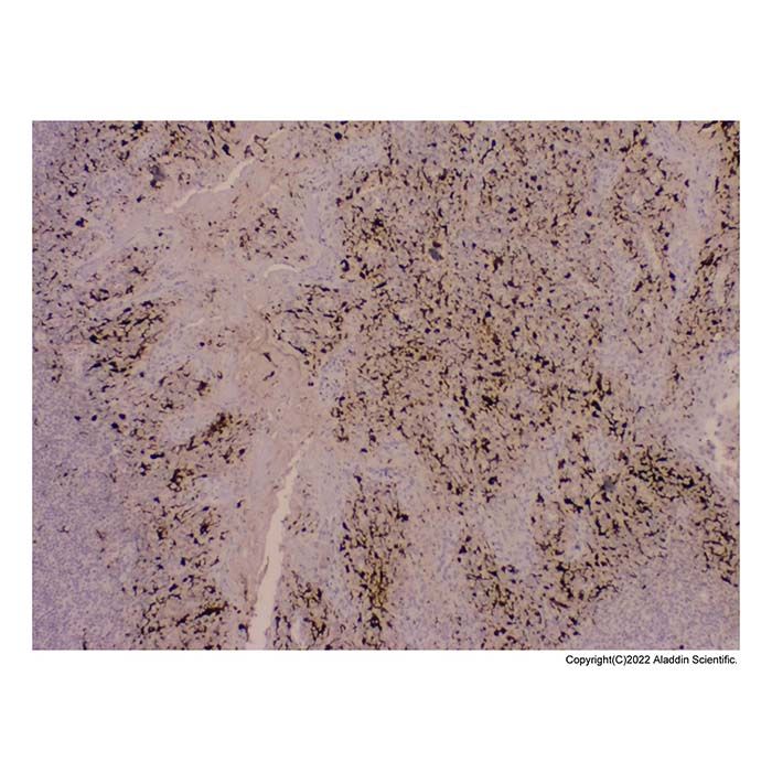 Recombinant S100 beta Antibody