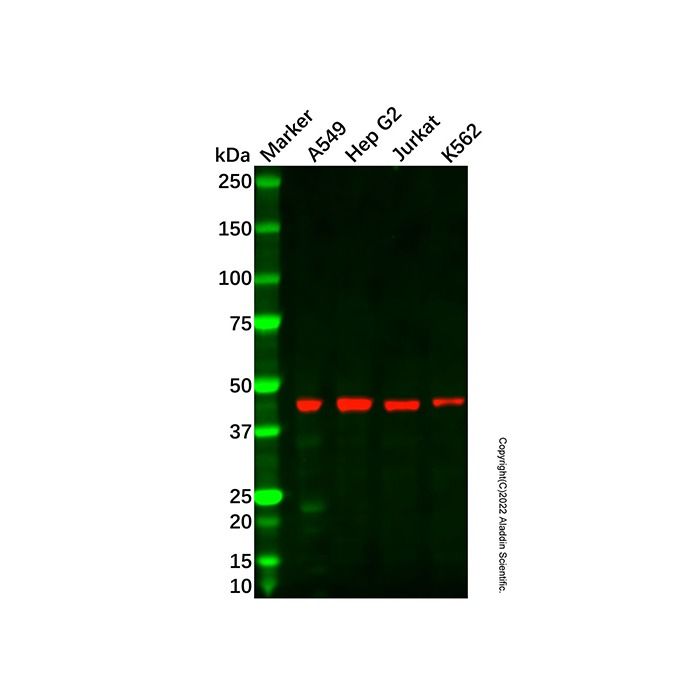 Recombinant SAHH Antibody