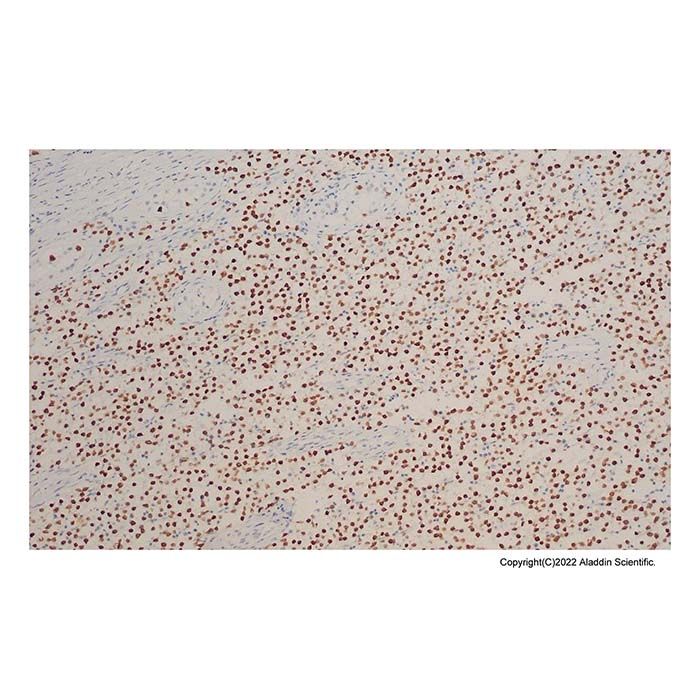 Recombinant Sall4 Antibody