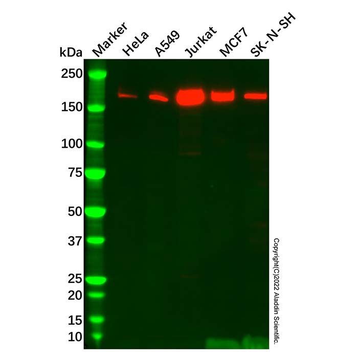 Recombinant SARA Antibody