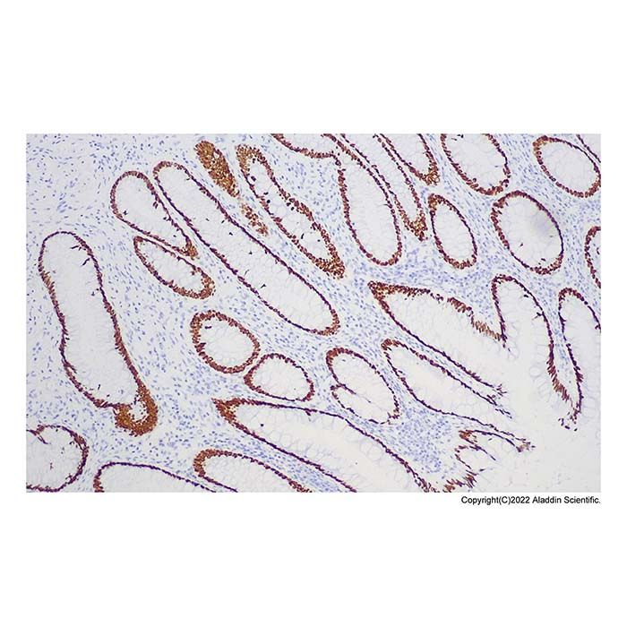 Recombinant SATB2 Antibody