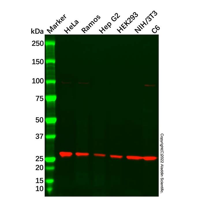 Recombinant SLC31A1/CTR1 Antibody