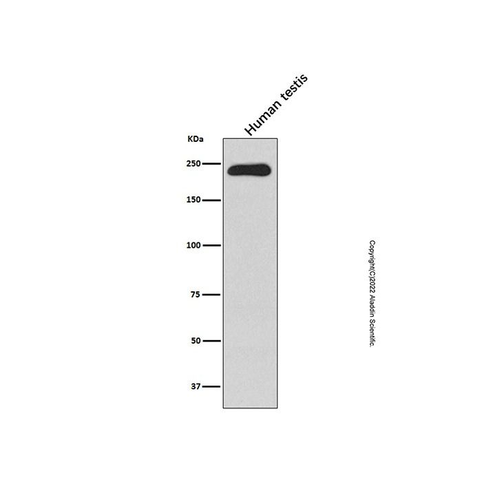 Recombinant smooth muscle Myosin heavy chain 11 Antibody