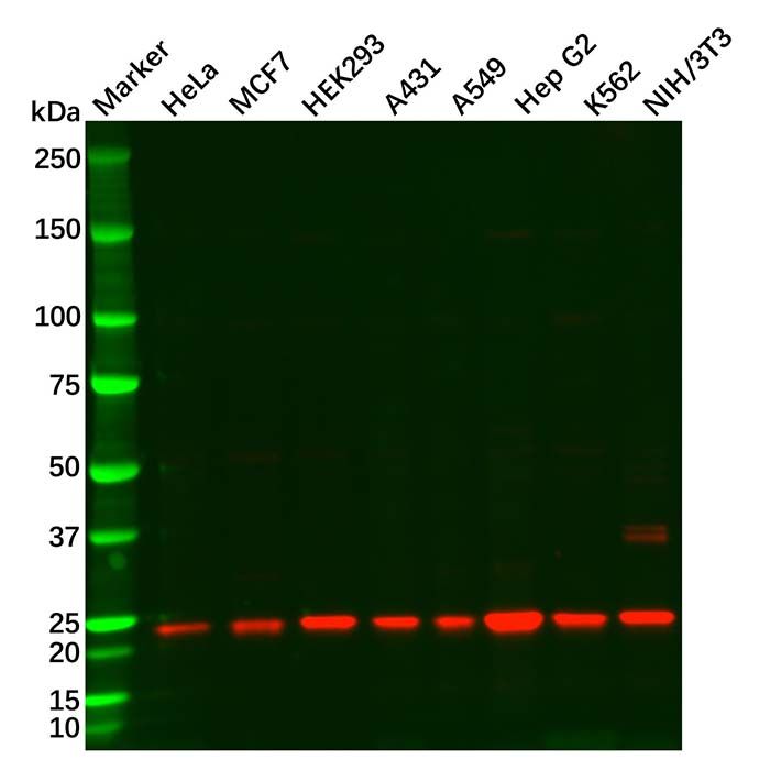 SOD2/MnSOD Antibody