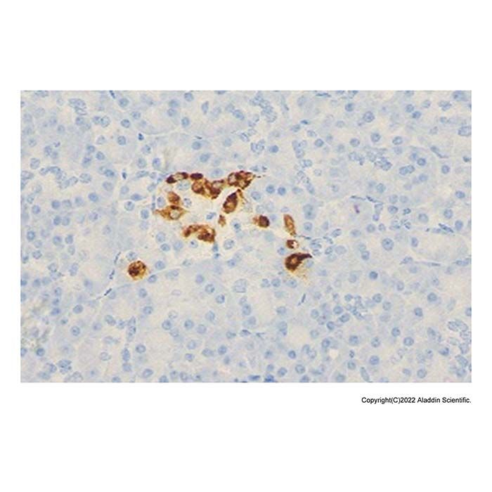 Recombinant Somatostatin Antibody