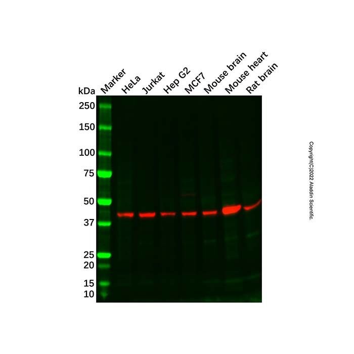 Recombinant Somatostatin Receptor 5 Antibody