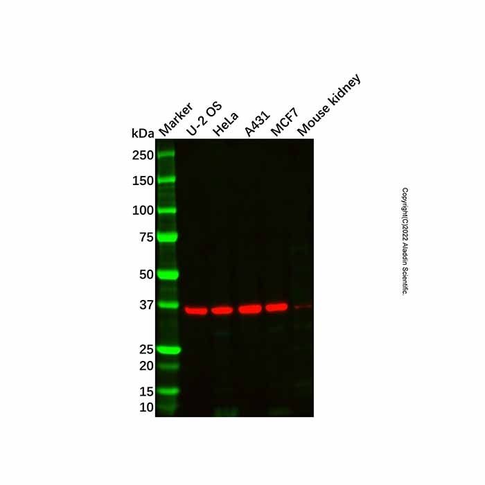 Sorbitol Dehydrogenase Antibody