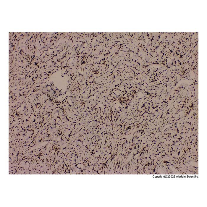 Recombinant STAT6 Antibody