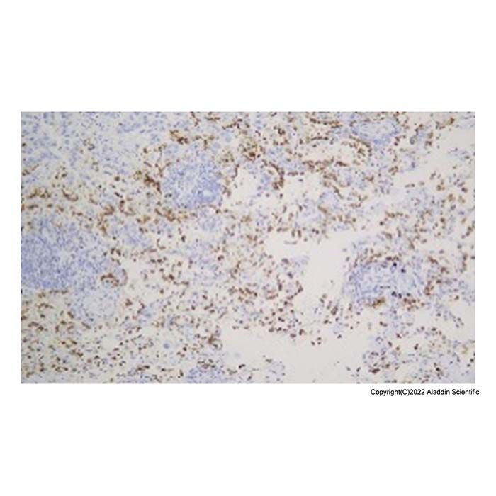 Recombinant Surfactant Protein B Antibody