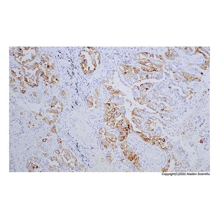 Recombinant TAG-72 Antibody