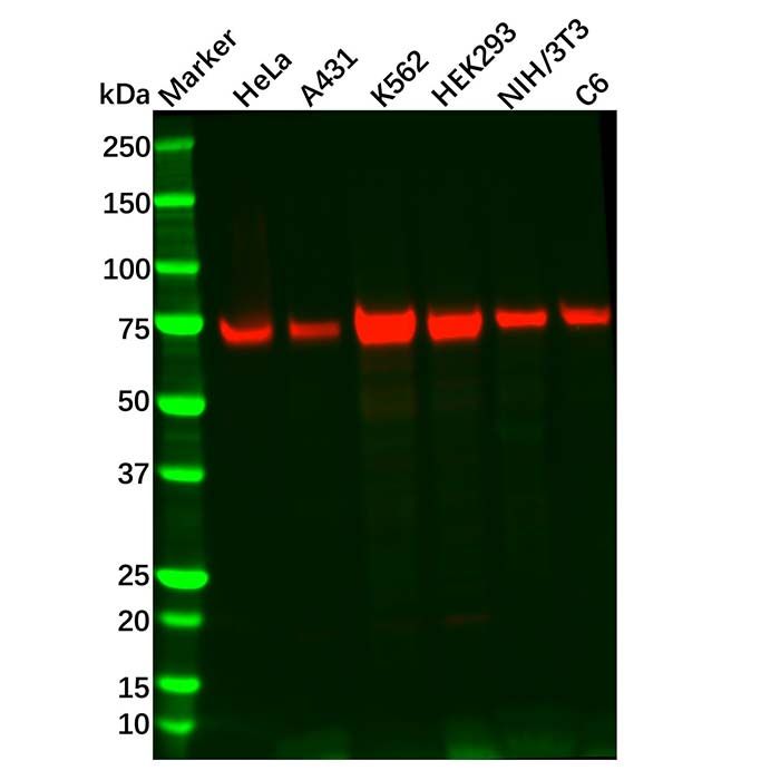 Recombinant TAK1 Antibody
