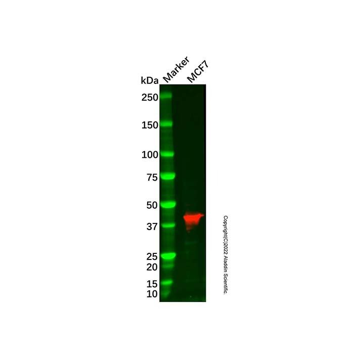 Recombinant TBP Antibody