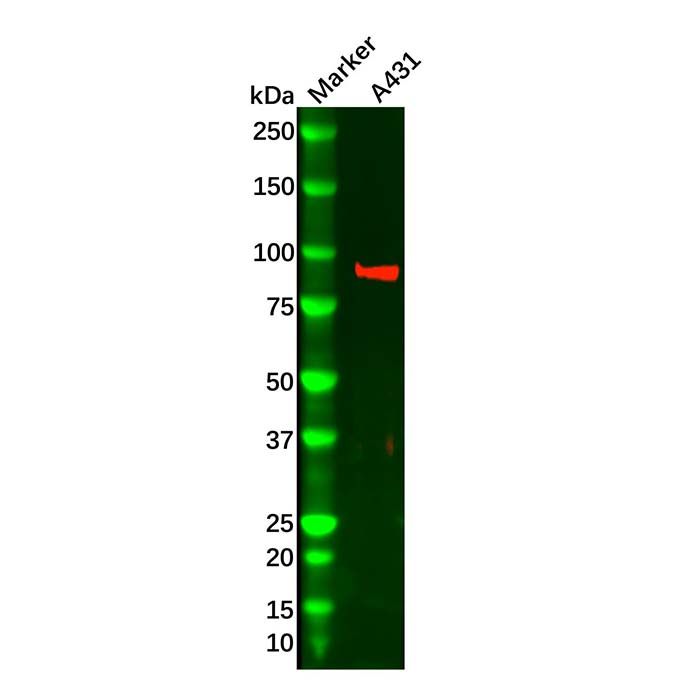 Thrombomodulin Mouse mAb
