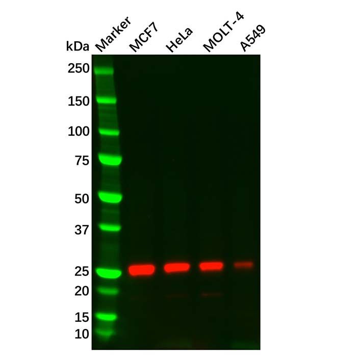 Thymidine Kinase 1/TK1 Mouse mAb