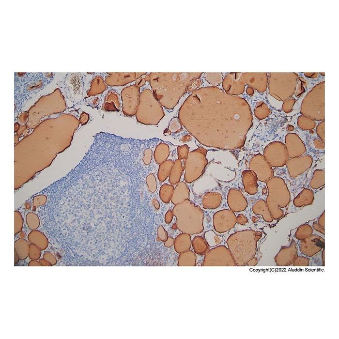 Recombinant Thyroglobulin Antibody