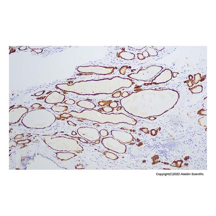 Recombinant Thyroid Peroxidase/TPO Antibody