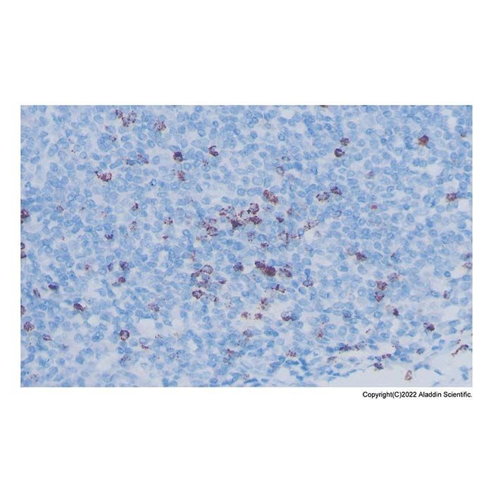 Recombinant TIA1 Antibody
