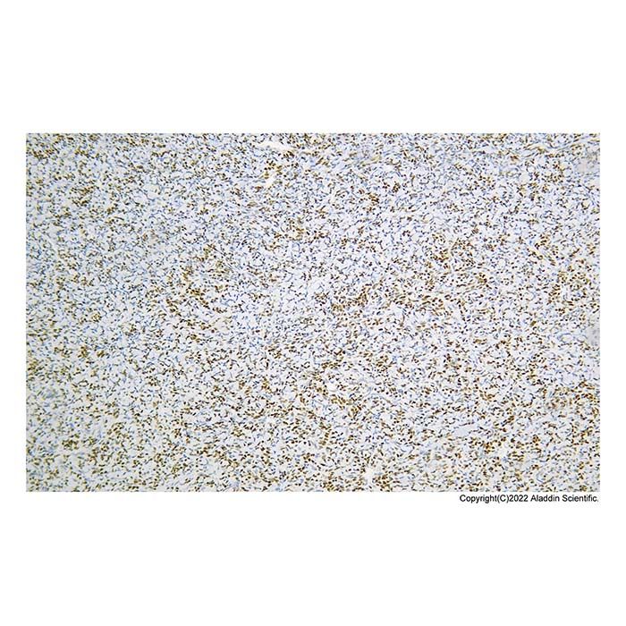 Recombinant TLE 1 Antibody
