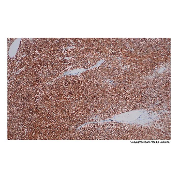 Recombinant TMEM16A Antibody