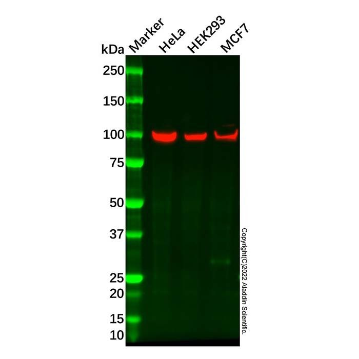 Recombinant TPX2 Antibody