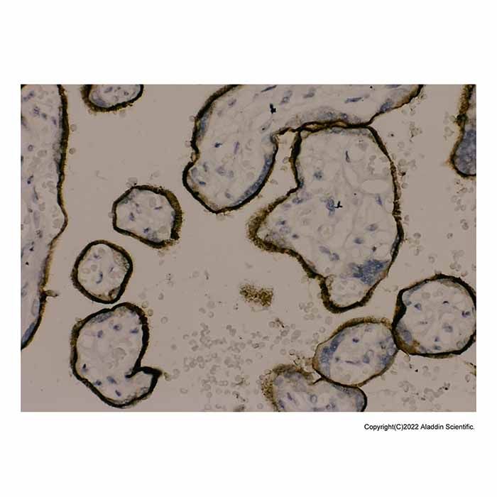 Recombinant Transferrin Receptor Antibody