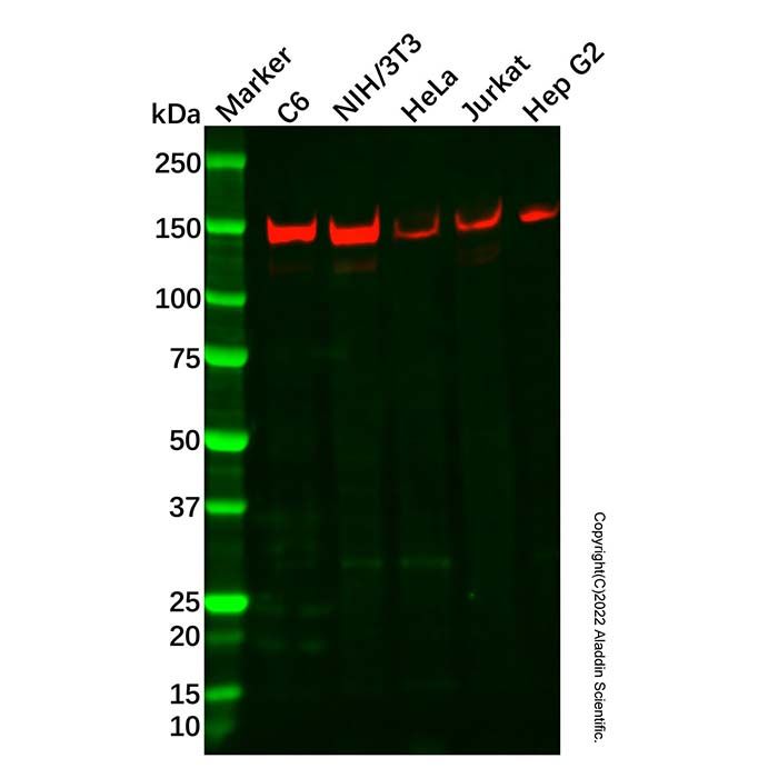Recombinant Tripeptidyl peptidase II/TPPII Antibody