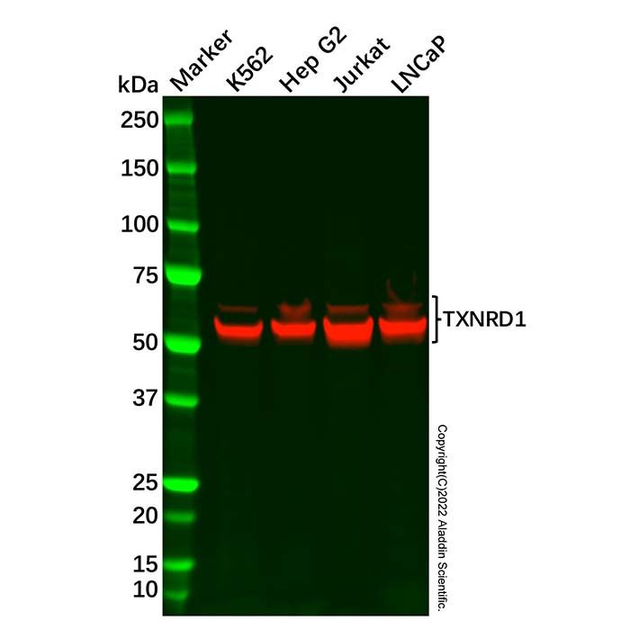 Recombinant TXNRD1 Antibody