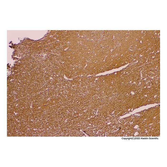 Recombinant Uroplakin III Antibody